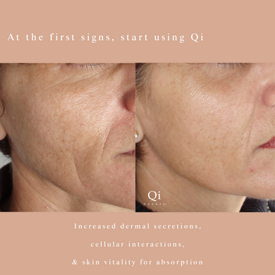 Qi Beauty Facial  Sydney